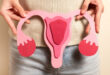 Komplikasi Gondok: Testis dan Ovarium Membengkak